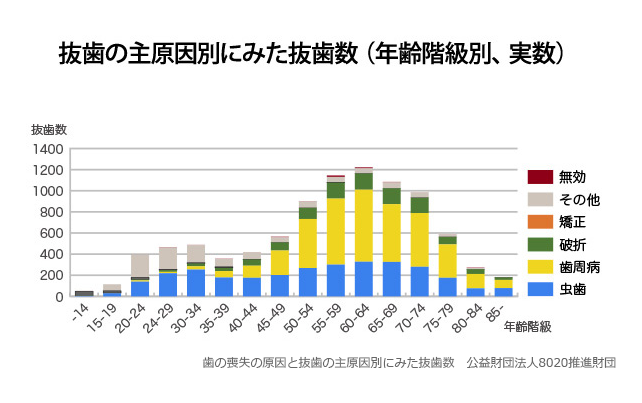 歯を失う原因