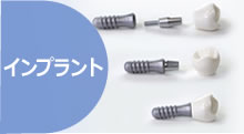 インプラント