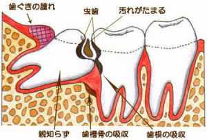 親知らず (1)