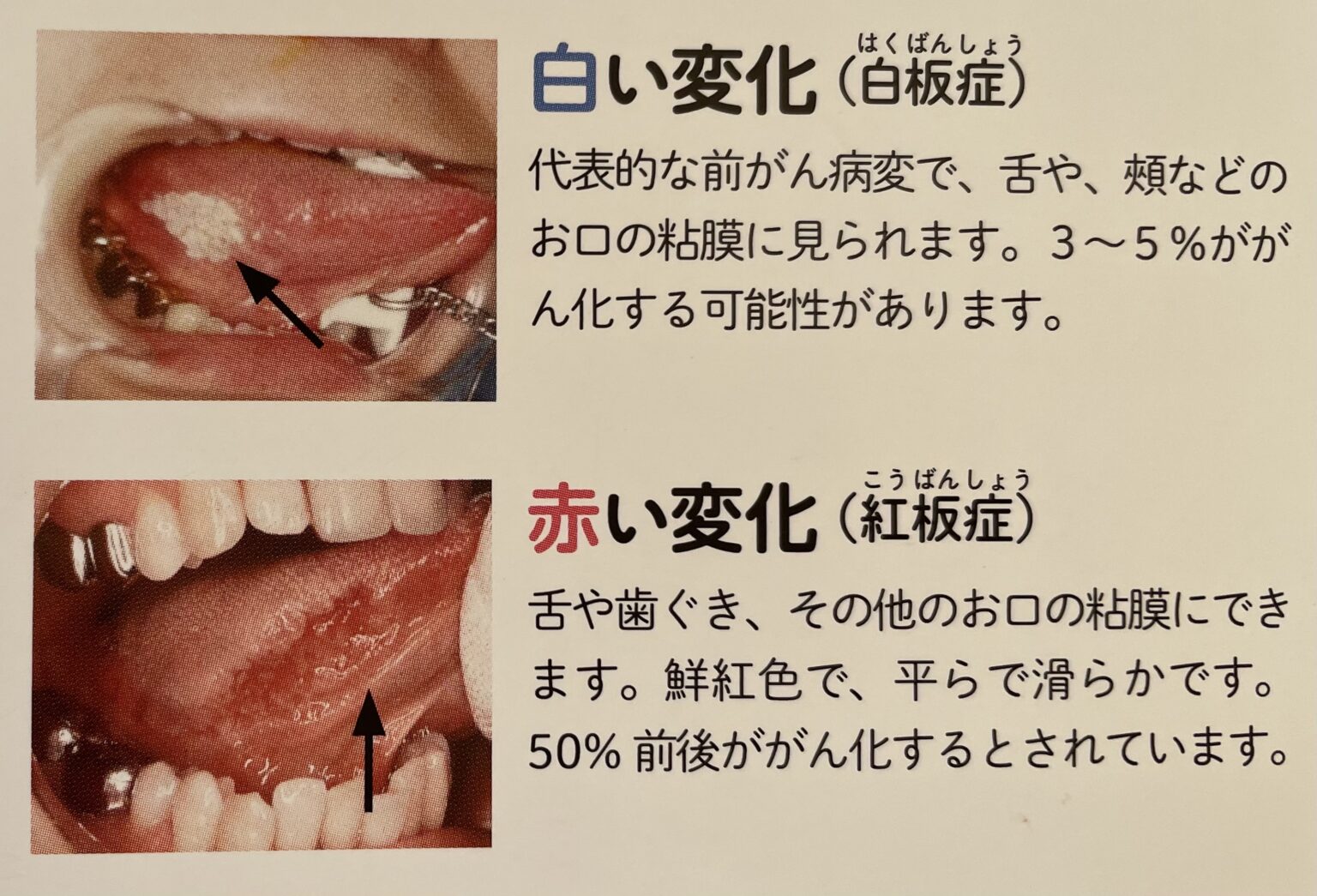 歯の豆知識 第93回 はじめよう!セルフチェックと歯科受診 | 歯の豆知識 | 岡山市のくれいし歯科クリニック